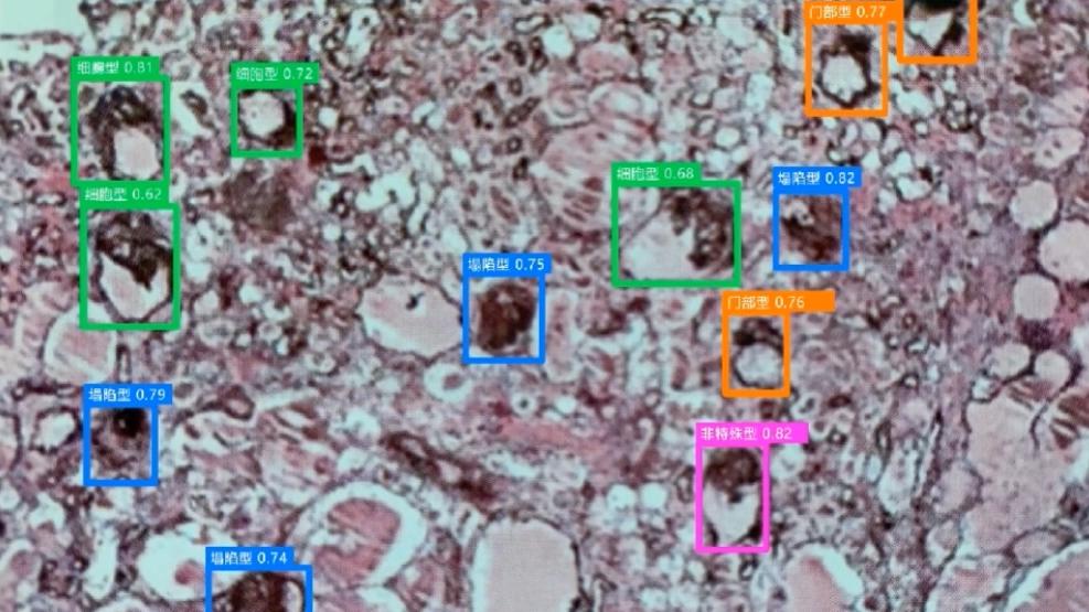 cbfcd2f99a2acffdc9b26fb88bd747f0__fallback_source=1&height=1280&mount_node_token=WgLWdyhJeokqKfx4tIJcWOFun0c&mount_point=docx_image&policy=allow_down&width=1280